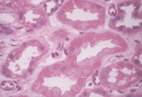 Kidney