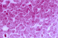 Low Power micrograph