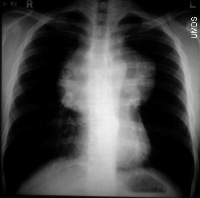 chest x-ray