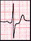 View ECG