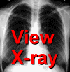 view x-ray