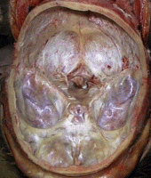 pituitary in situ