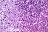 Pituitary