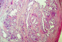 section of prostate