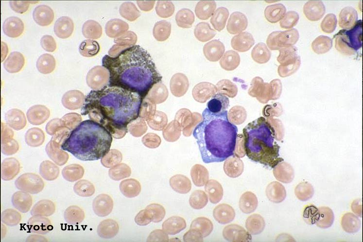 Peroxidase Stain